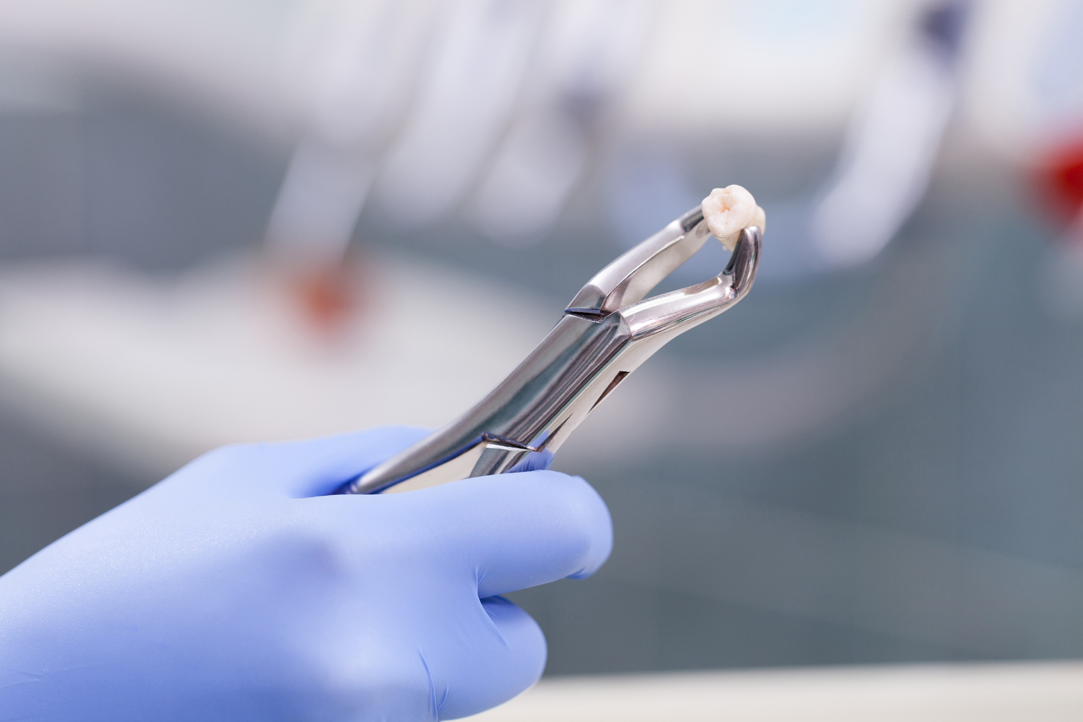 A gloved hand holds dental forceps gripping an extracted tooth, set against a blurred background of dental equipment