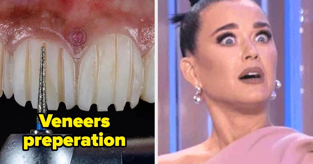 57 Truly Mind-Boggling Photos Of The Human Body That Had Me A Little Disturbed, But Also Endlessly Fascinated