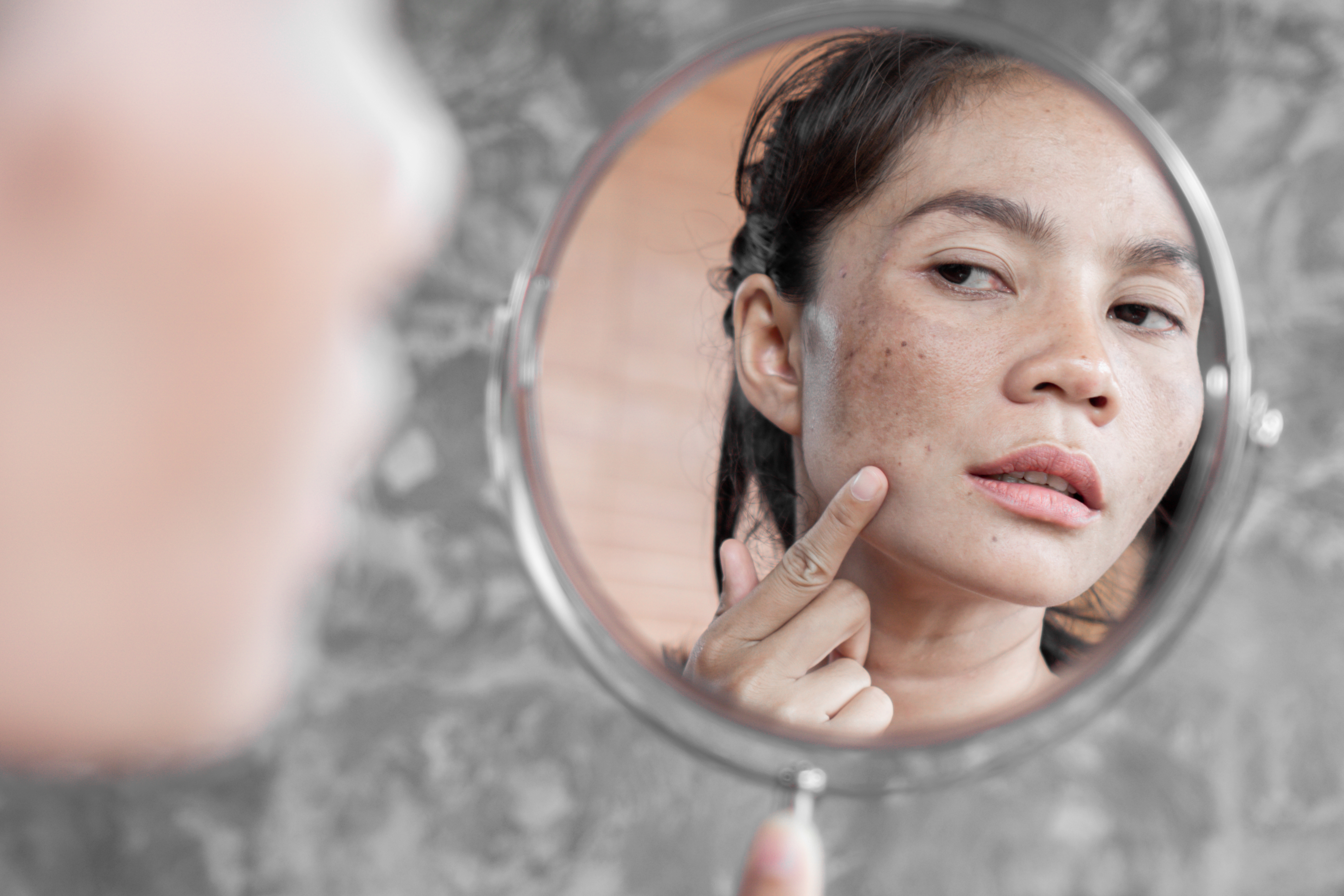 A person examines their face in a round mirror, focusing on small blemishes or marks on their skin