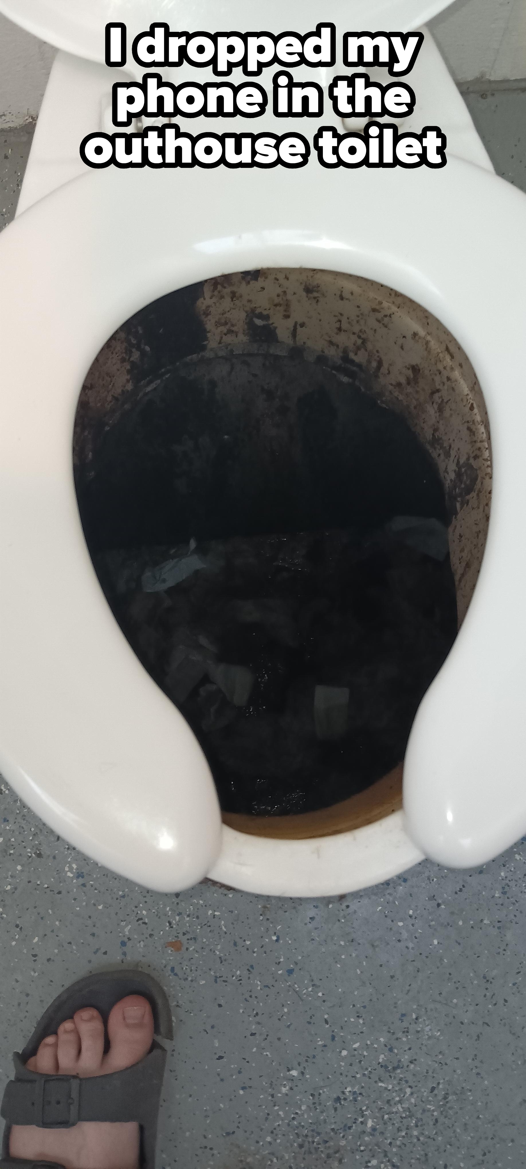 Dirty toilet bowl with dark liquid, shown up close. A person's foot in a sandal is visible near the toilet