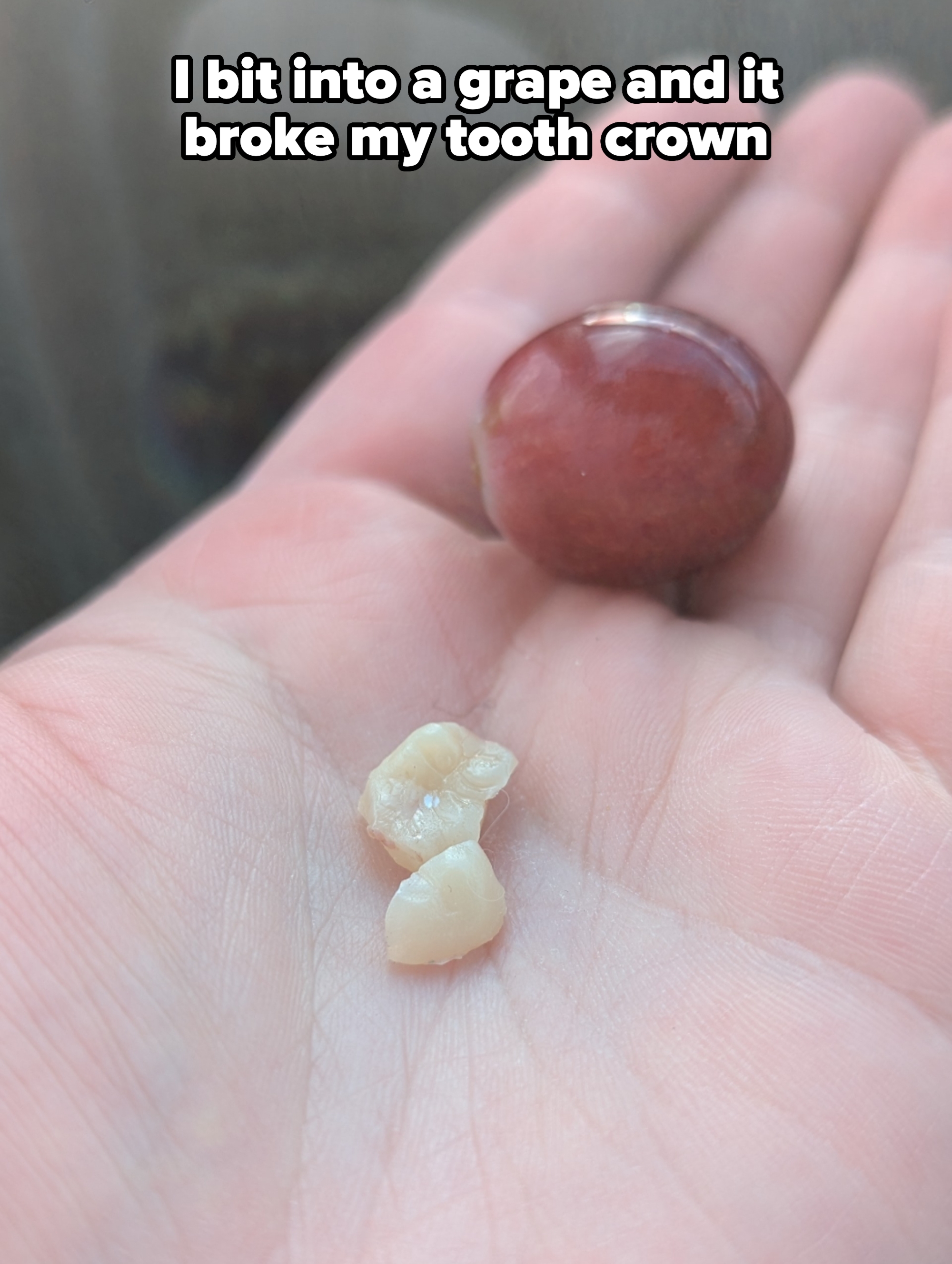 A hand holds a cherry pit and two small, broken teeth