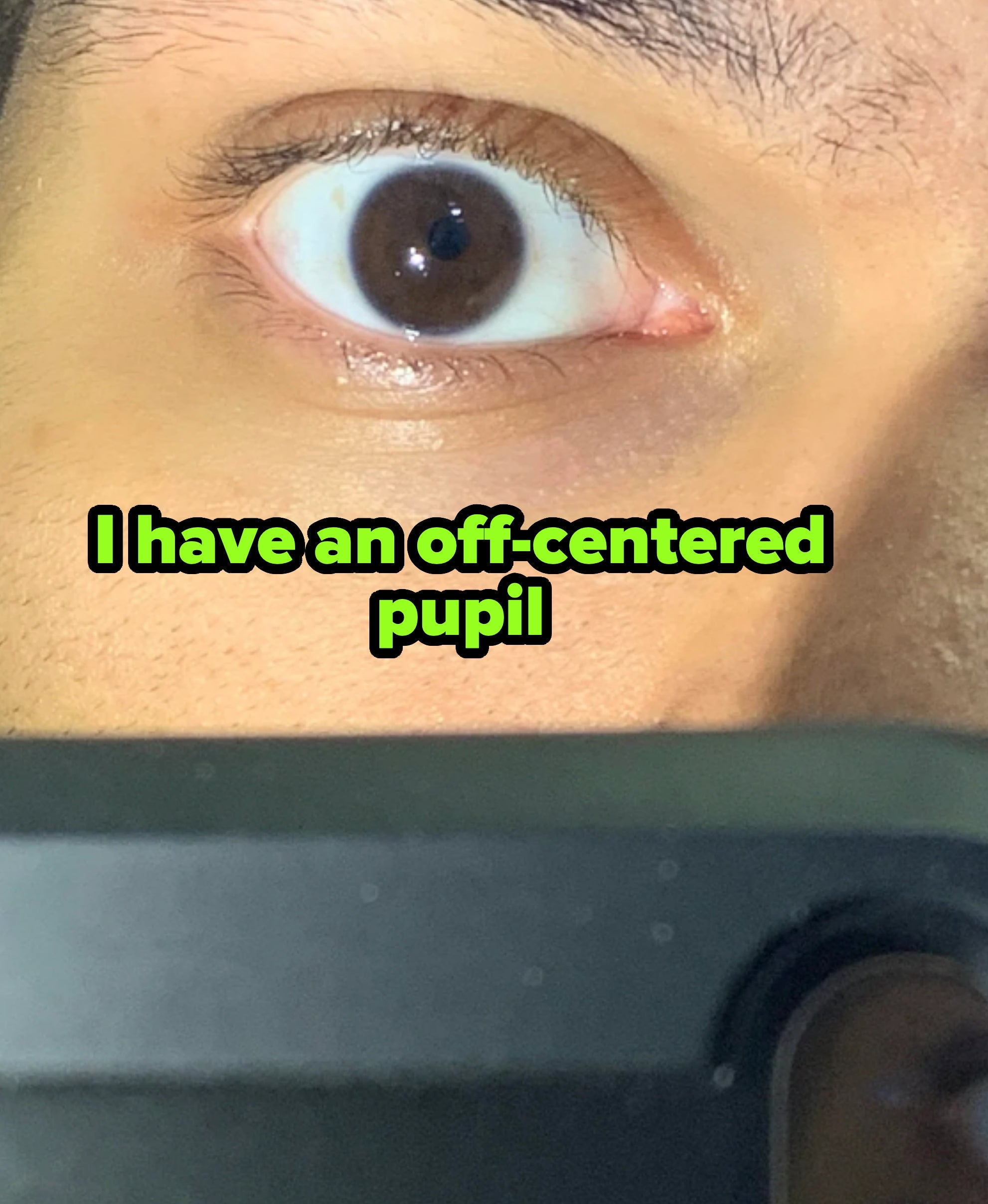 Eye with off-center pupil