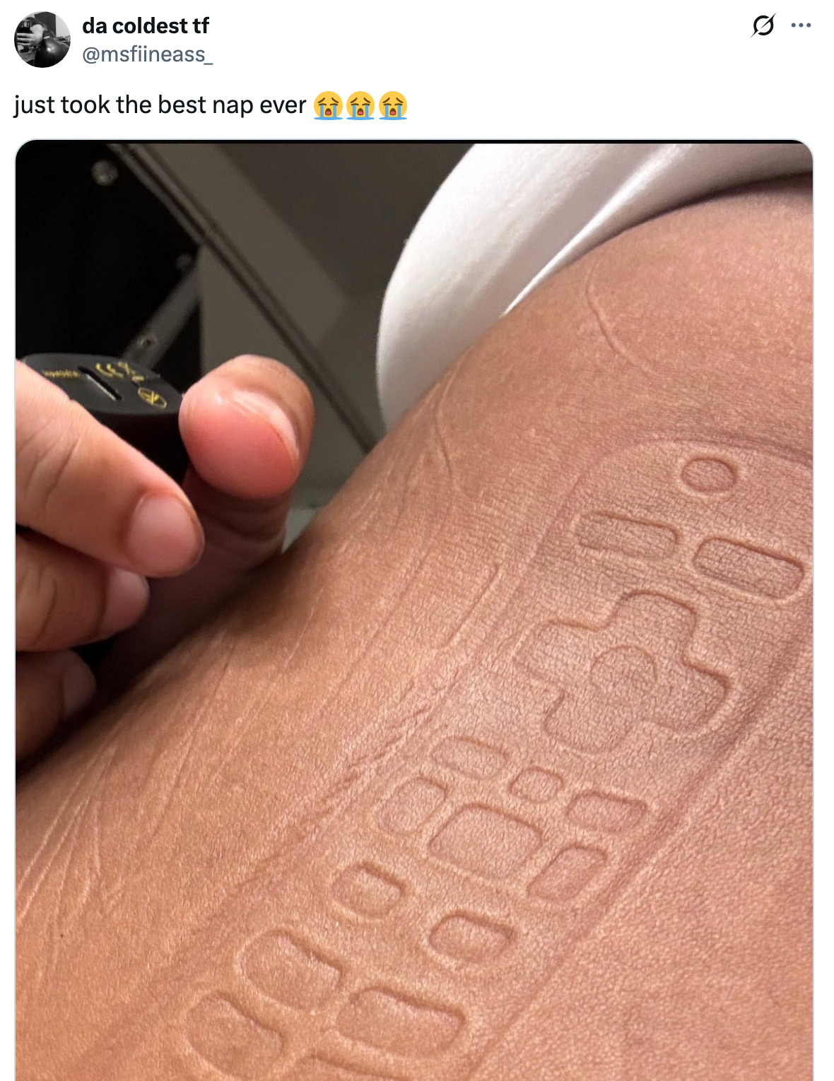 Imprint of a TV remote on skin, suggesting a deep nap; hand visible. Caption reads: "just took the best nap ever" with crying emojis