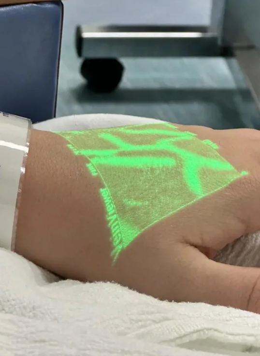 A hand under a vein finder, which projects green light to reveal the vein pattern for easy access
