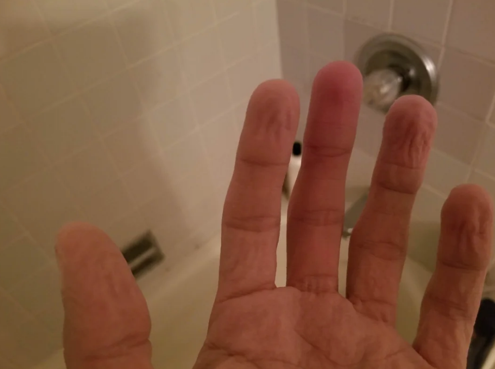 Wrinkled fingers are shown close up, with a tub shown behind them. One finger is not wrinkled