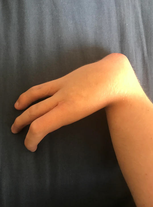 A close-up of a hand bent at a right angle from the wrist, with only three fingers