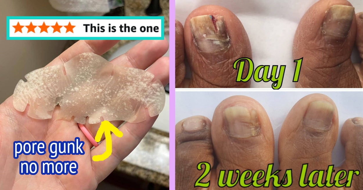 37 Personal Care Problem Solvers That Work So Well, You'll Feel Like You've Made A Groundbreaking Discovery