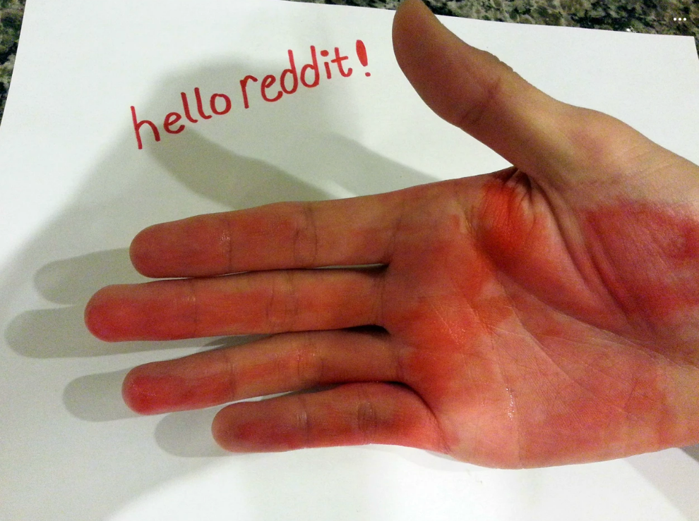 A palm sweating red with the message "hello reddit!" written on paper behind it