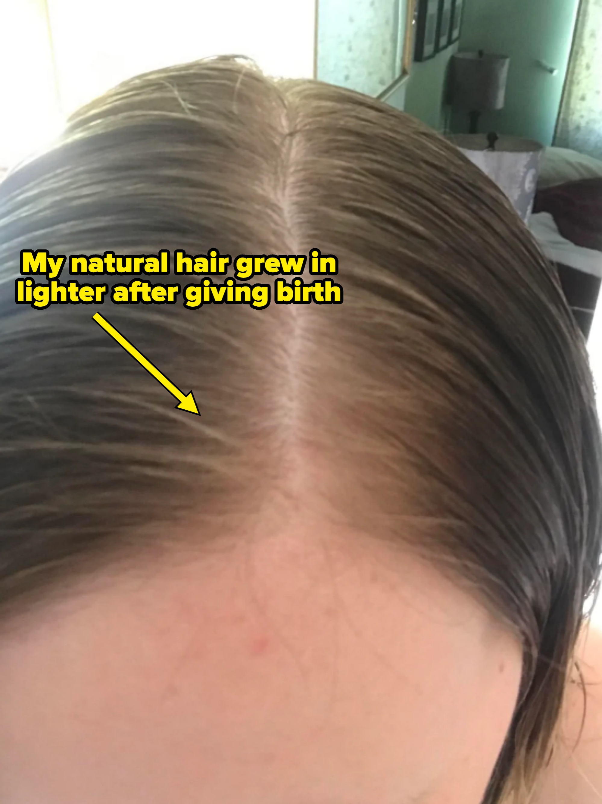 Top view of a person's scalp with lighter roots. Caption: "My natural hair grew in lighter after giving birth"