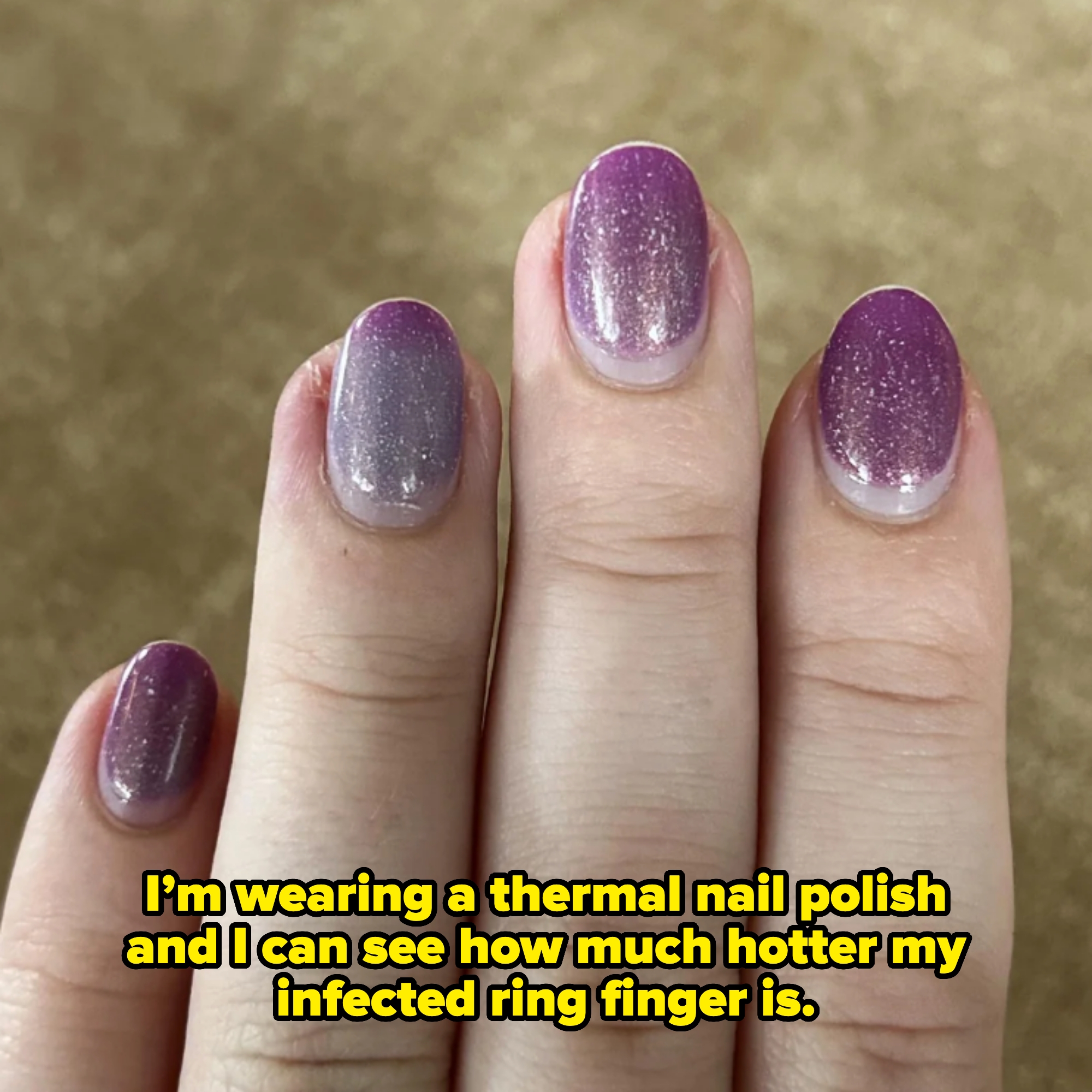 A hand displays a manicure with short nails; the nail polish color on the ring finger is different. Caption: "I’m wearing a thermal nail polish and I can see how much hotter my infected ring finger is"
