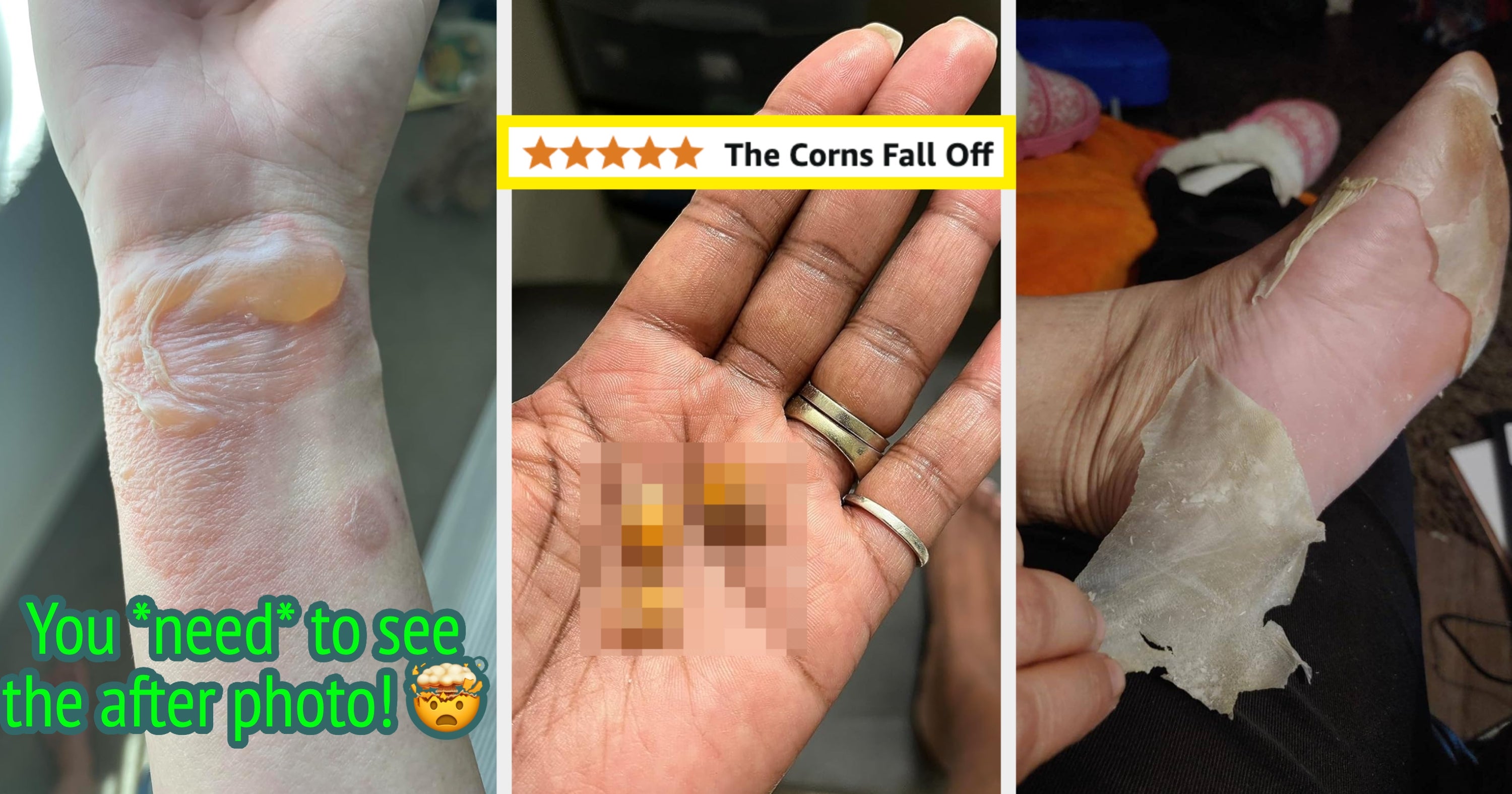 Do *Not* Click This Post If You’re Squeamish: 17 Personal Care Products With Gnarly Before And After Photos
