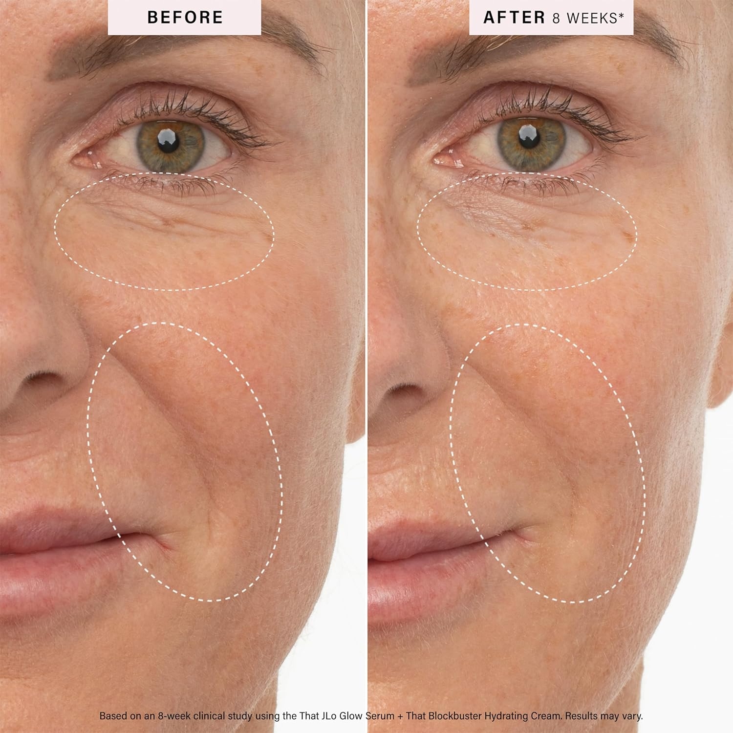 Side-by-side comparison of a models's face showing skin texture improvement after using a product for 8 weeks