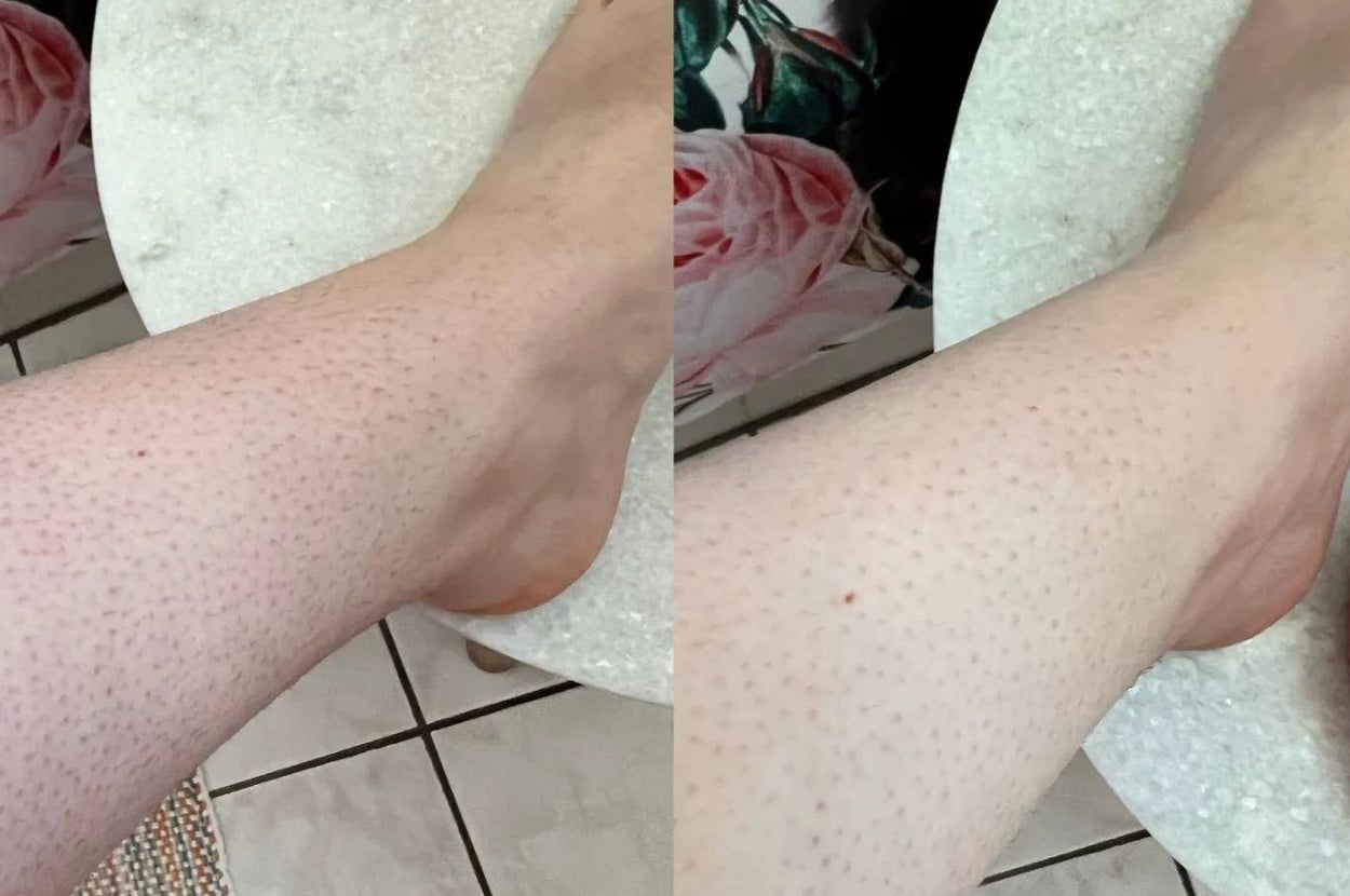 This Cheap Viral Tool Actually Removed My Leg Hair