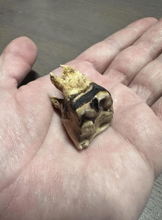 A hand holds a large decayed tooth with distinct ridges