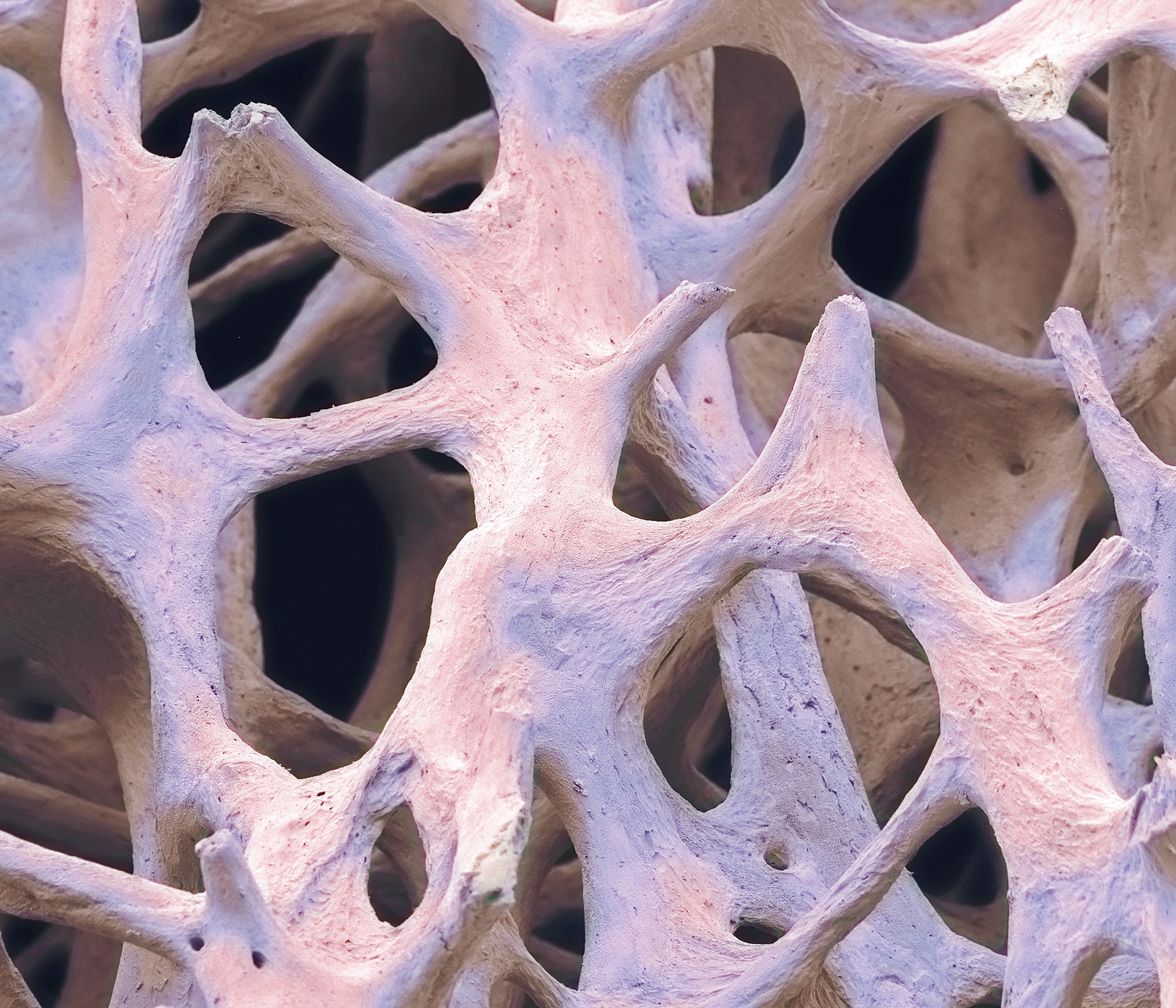 Close-up of a bone structure with a porous, spongy texture showing interconnected cavities and arches