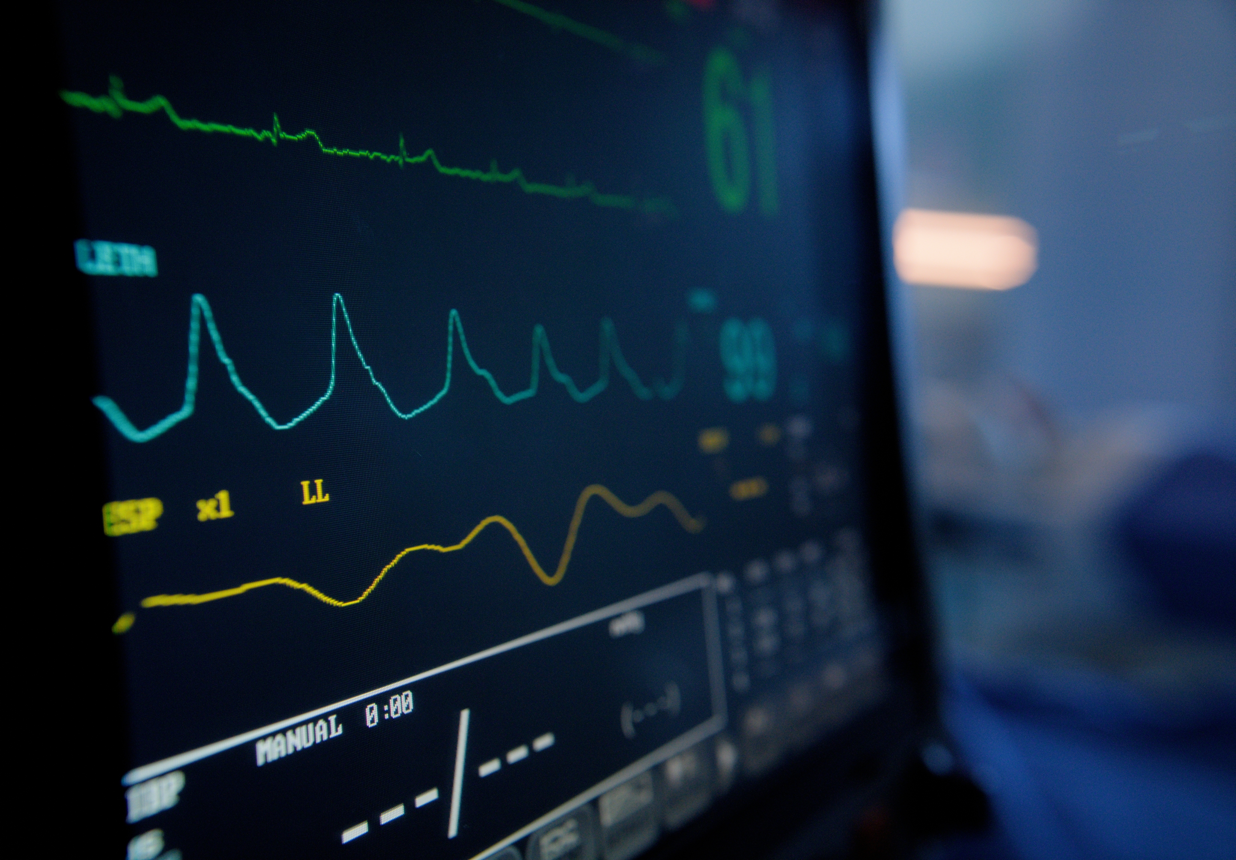 Close-up of a heart monitor screen showing vital signs and fluctuating heart rate readings