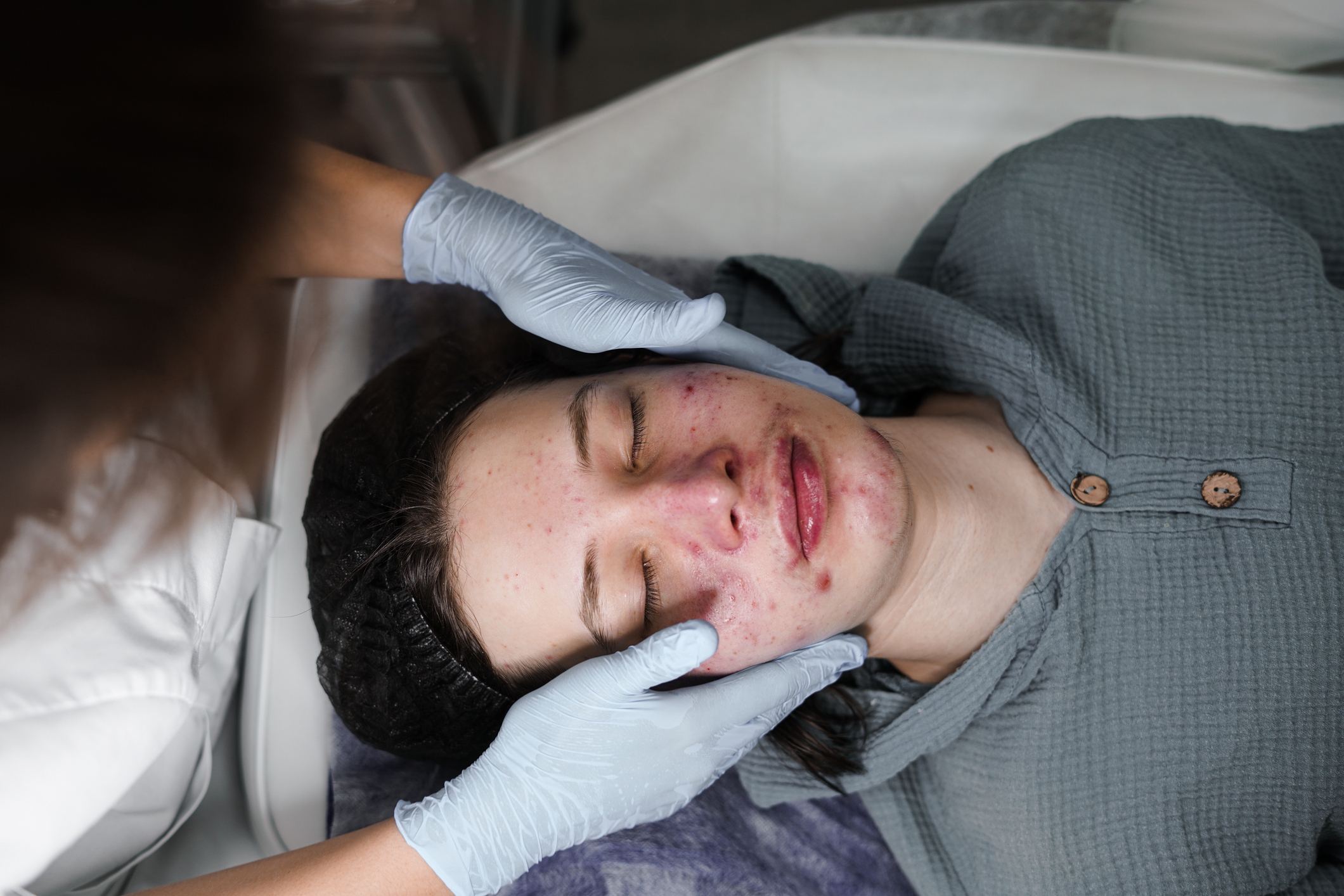 Person som mottar en ansiktsbehandling, ligger på et spa -bord. En estetiker holder ansiktet forsiktig og bruker hansker