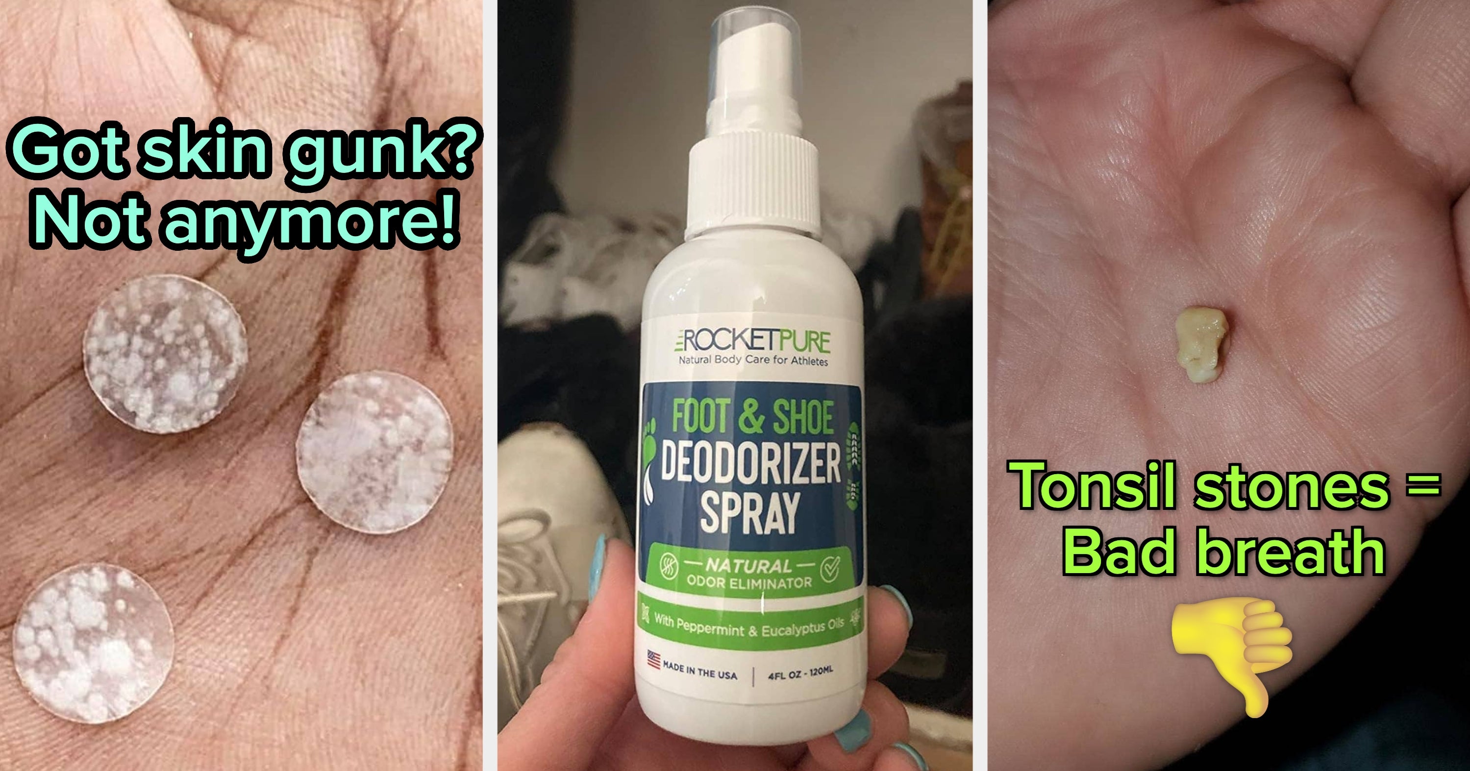 Don't Be Ashamed, These 33 Products Can Help With Those Embarrassing But Very Human Problems