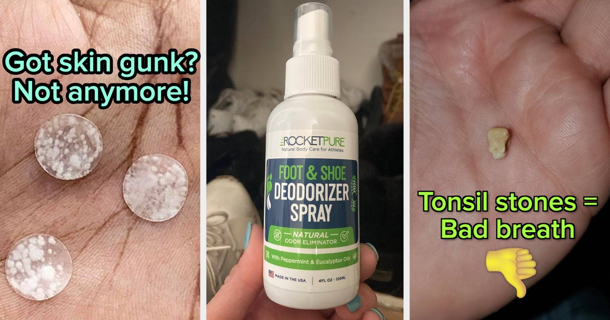 Don't Be Ashamed, These 33 Products Can Help With Those Embarrassing But Very Human Problems