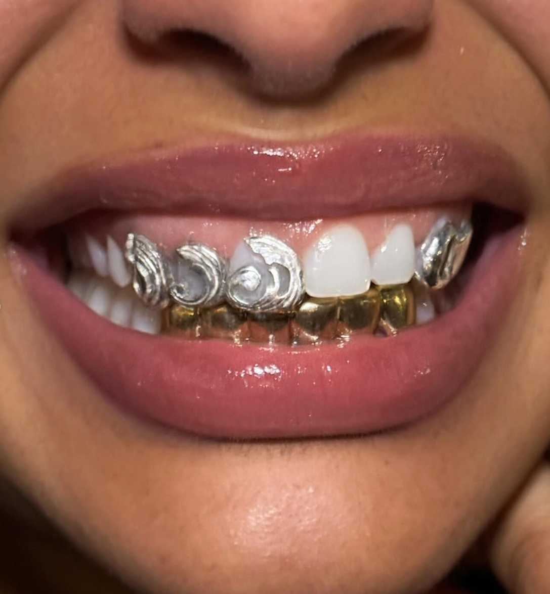 A close-up of a smile showcasing silver and gold decorative dental grills on the top and bottom teeth