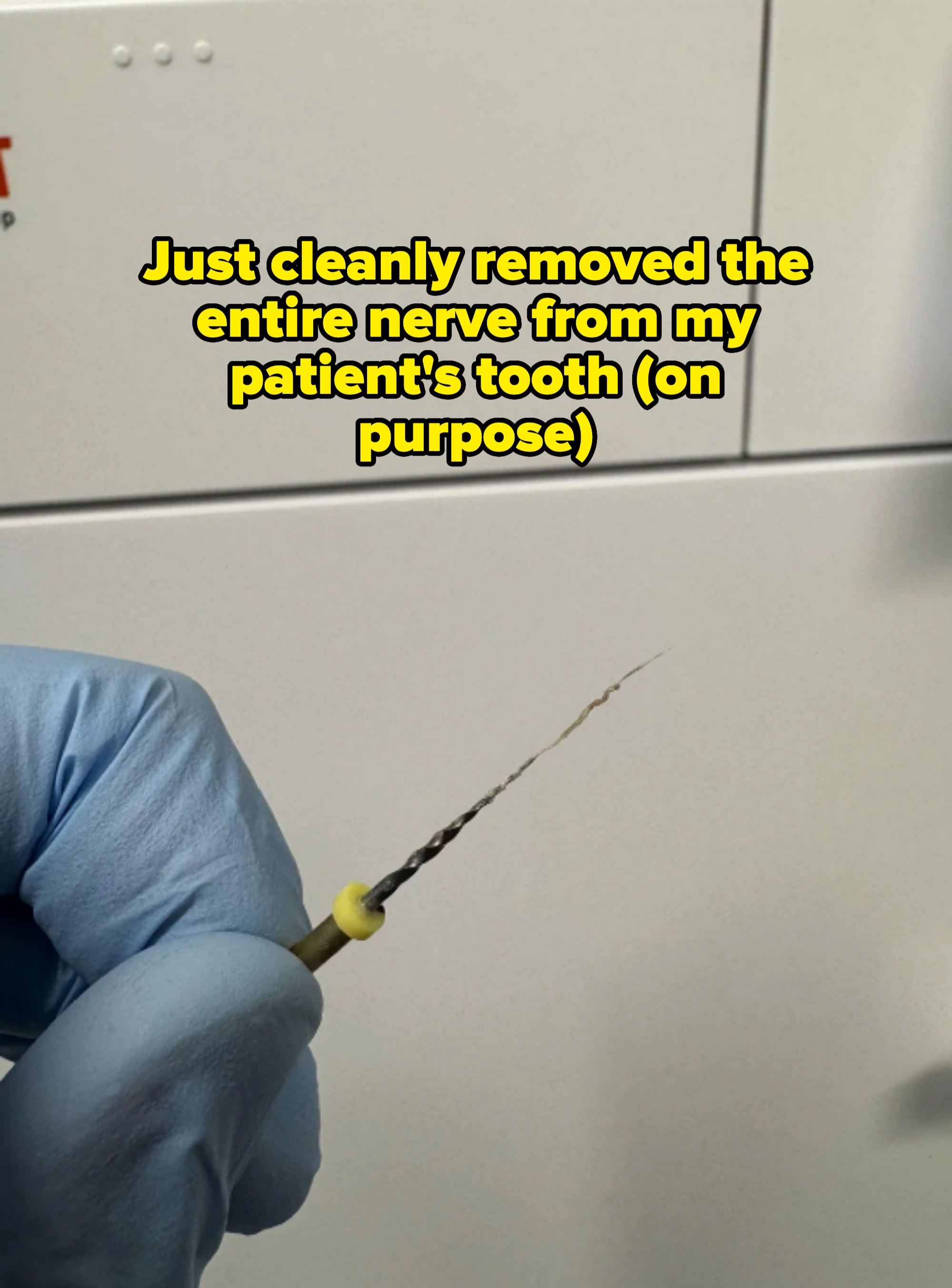 A gloved hand holds a dental instrument with a thin, coiled tip, likely used for endodontic procedures