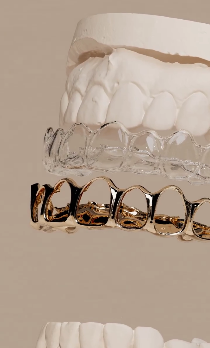 Dental molds and clear aligners above a set of decorative gold grills on a beige background