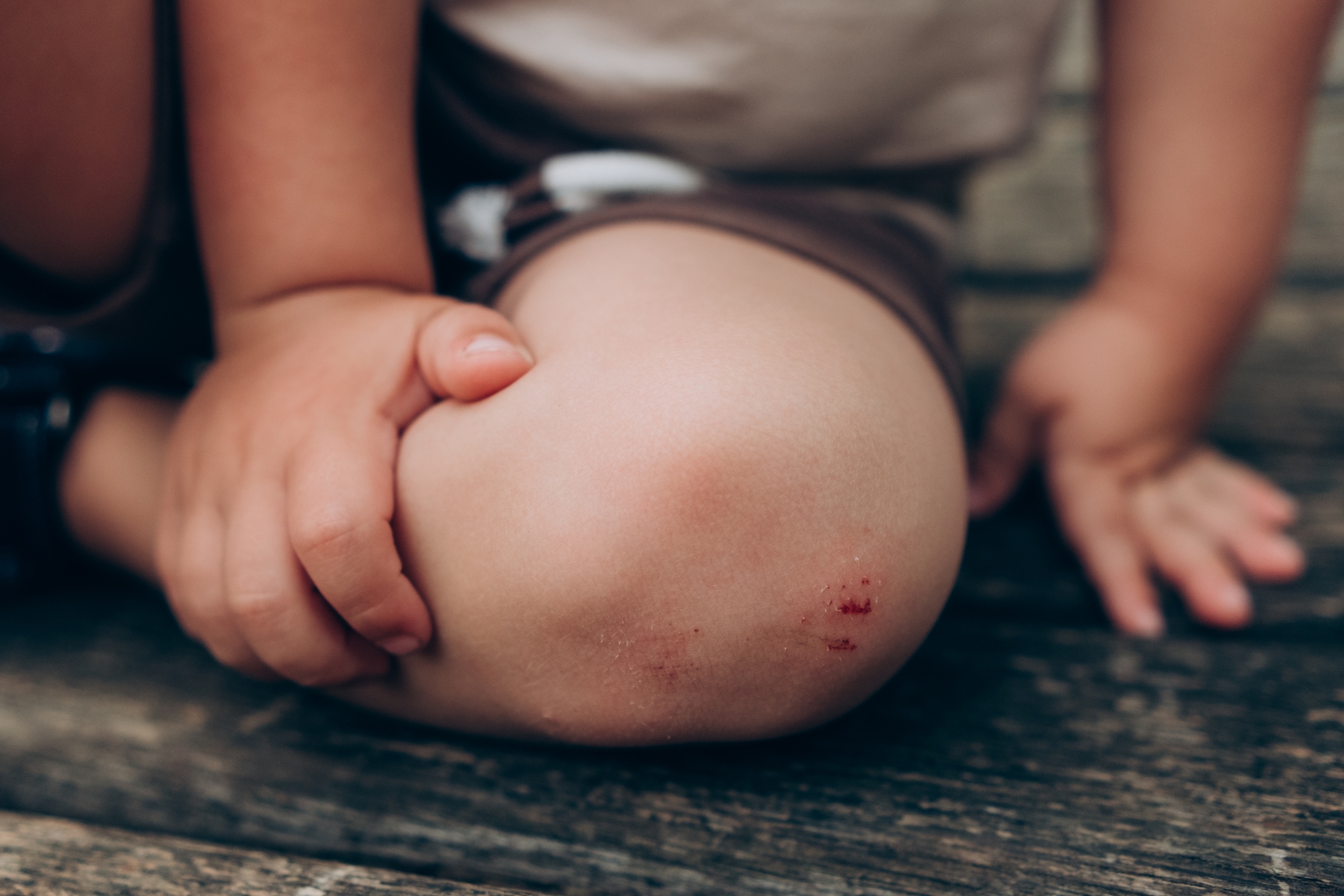 Child holding a slightly injured knee with a small scrape, sitting on wooden steps