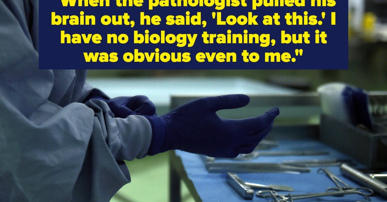 People Who Perform Autopsies Are Sharing The Weirdest Anomalies They've Found, And The Body Is Wild