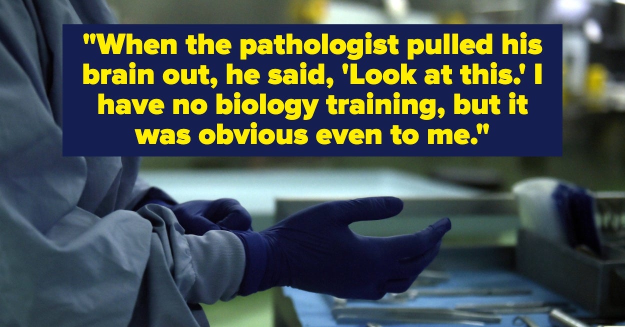 People Who Perform Autopsies Are Sharing The Weirdest Anomalies They've Found, And The Body Is Wild