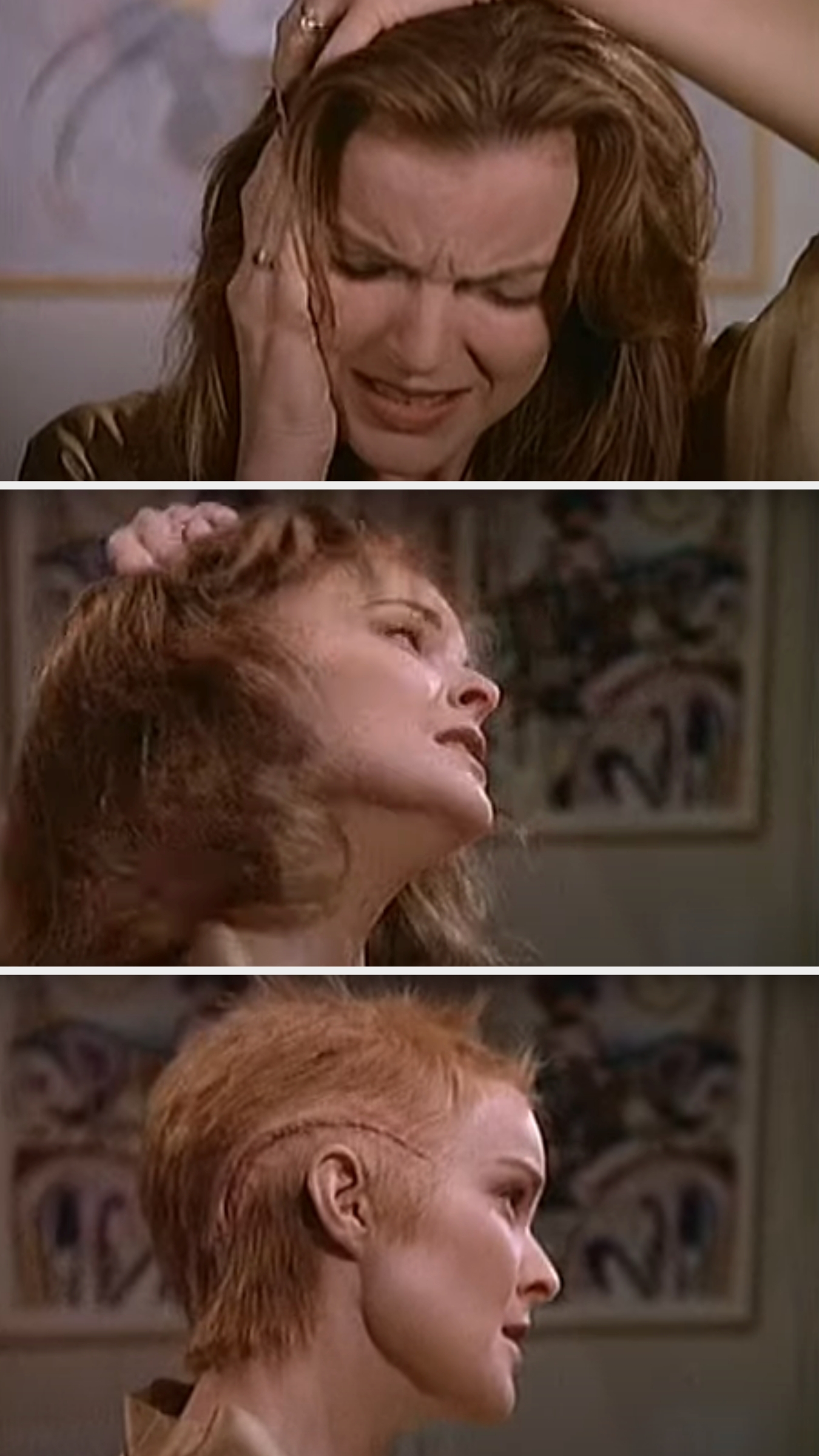 Kimberly removes her wig, revealing a large scar on her scalp