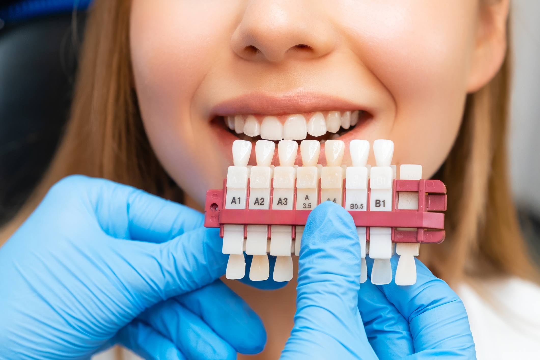 Person smiling while a dentist holds a shade guide to match tooth color for potential dental work