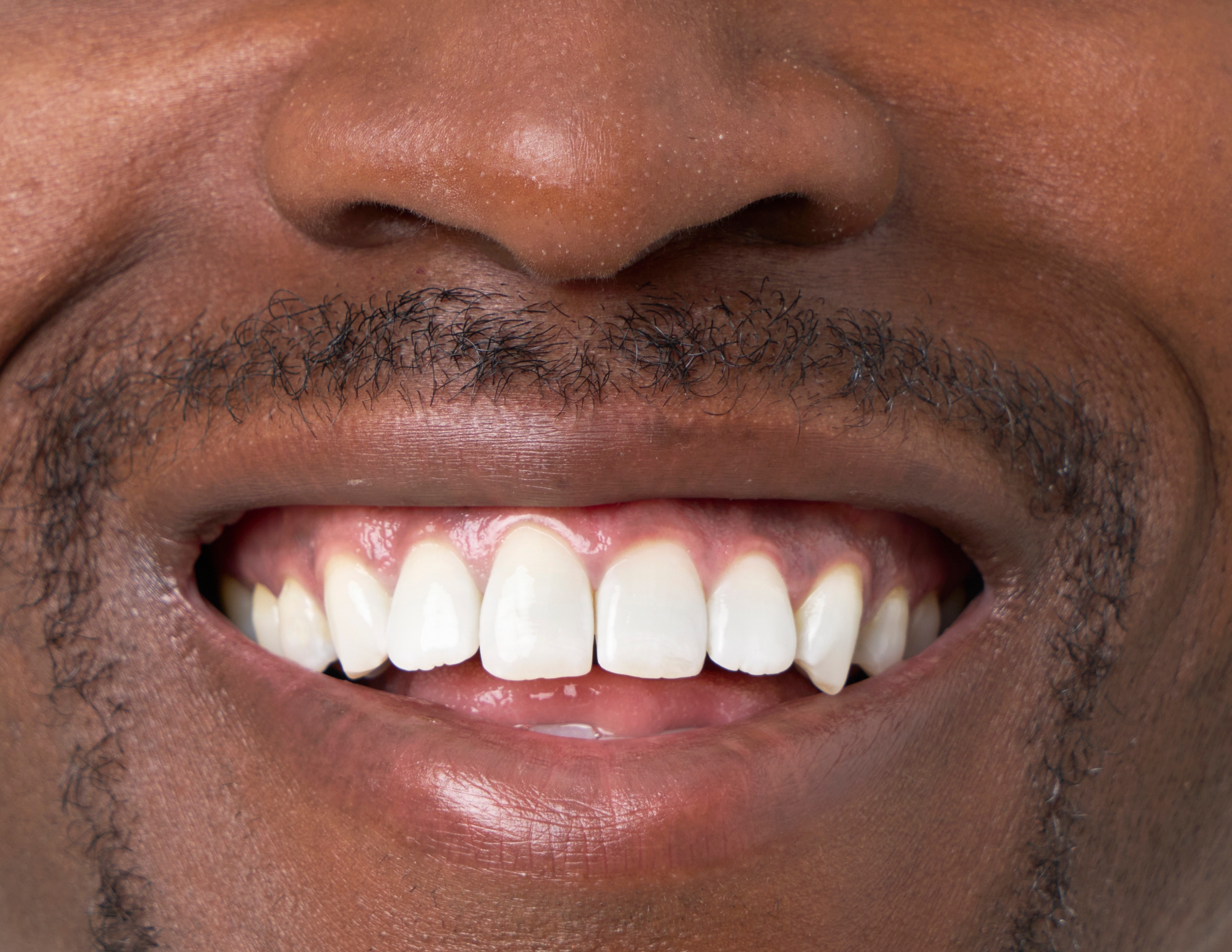 Close-up of a person smiling, showing healthy teeth and a joyful expression