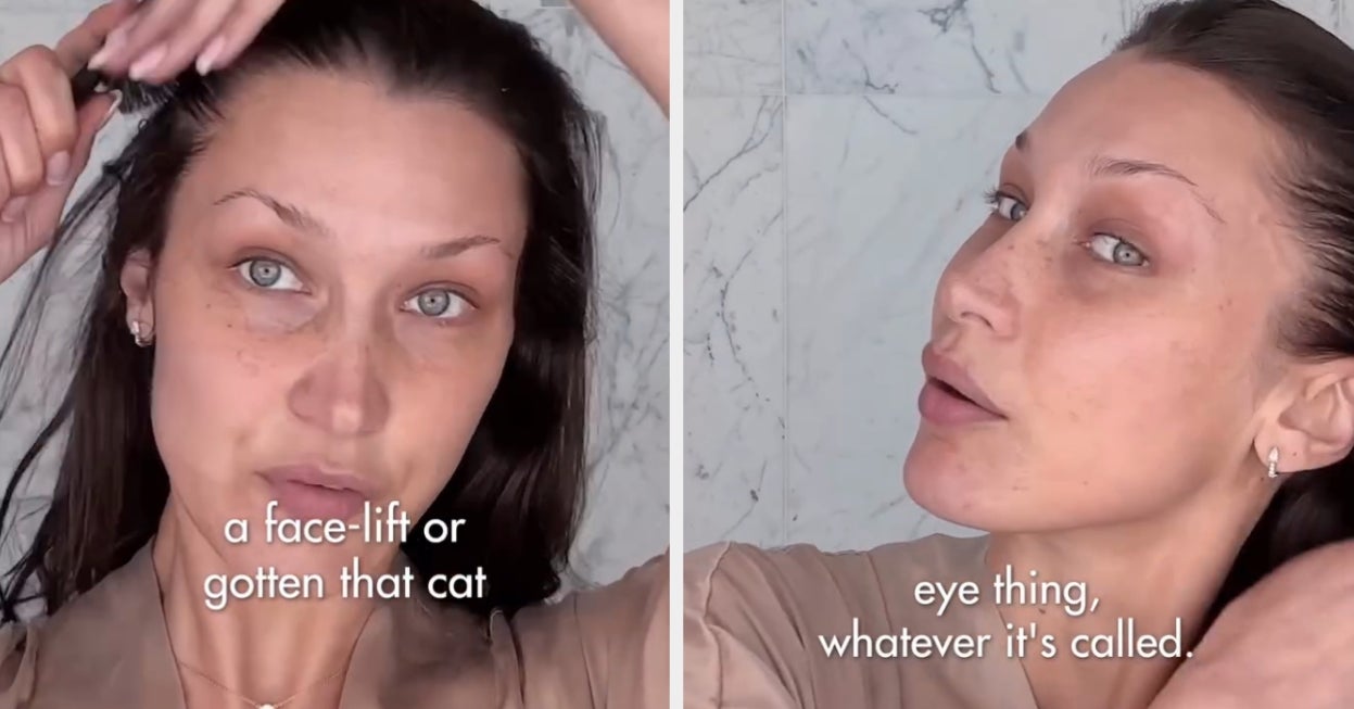 Bella Hadid Addressed Facelift And Fox Eye Lift Surgery Rumors