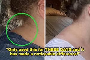 A reviewer with a neck hump and that same reviewer without a neck hump. Text reads: "Only used this for THREE DAYS and it has made a noticeable difference!"
