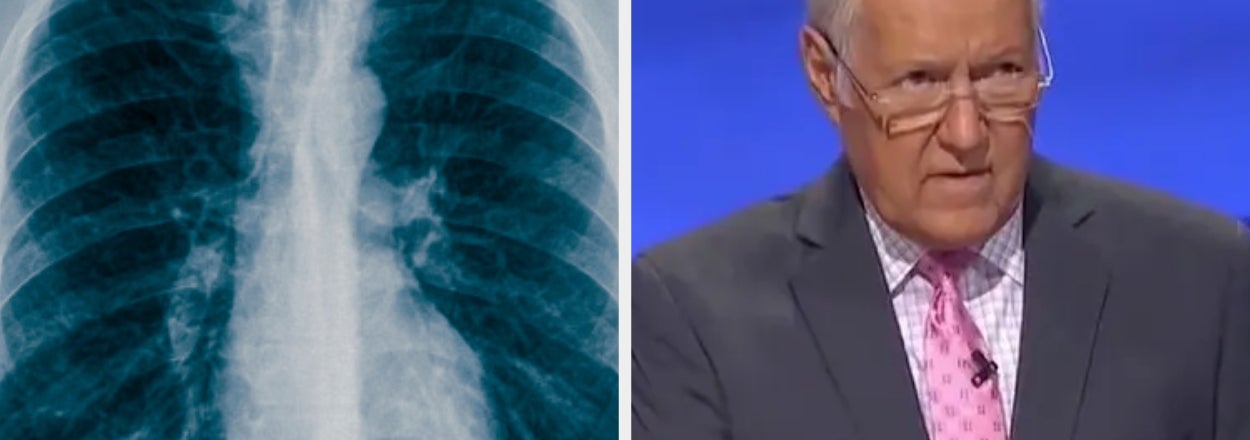 If You Can Pass This Medical-Themed "Jeopardy!," Congrats! You're Smarter Than The Average American