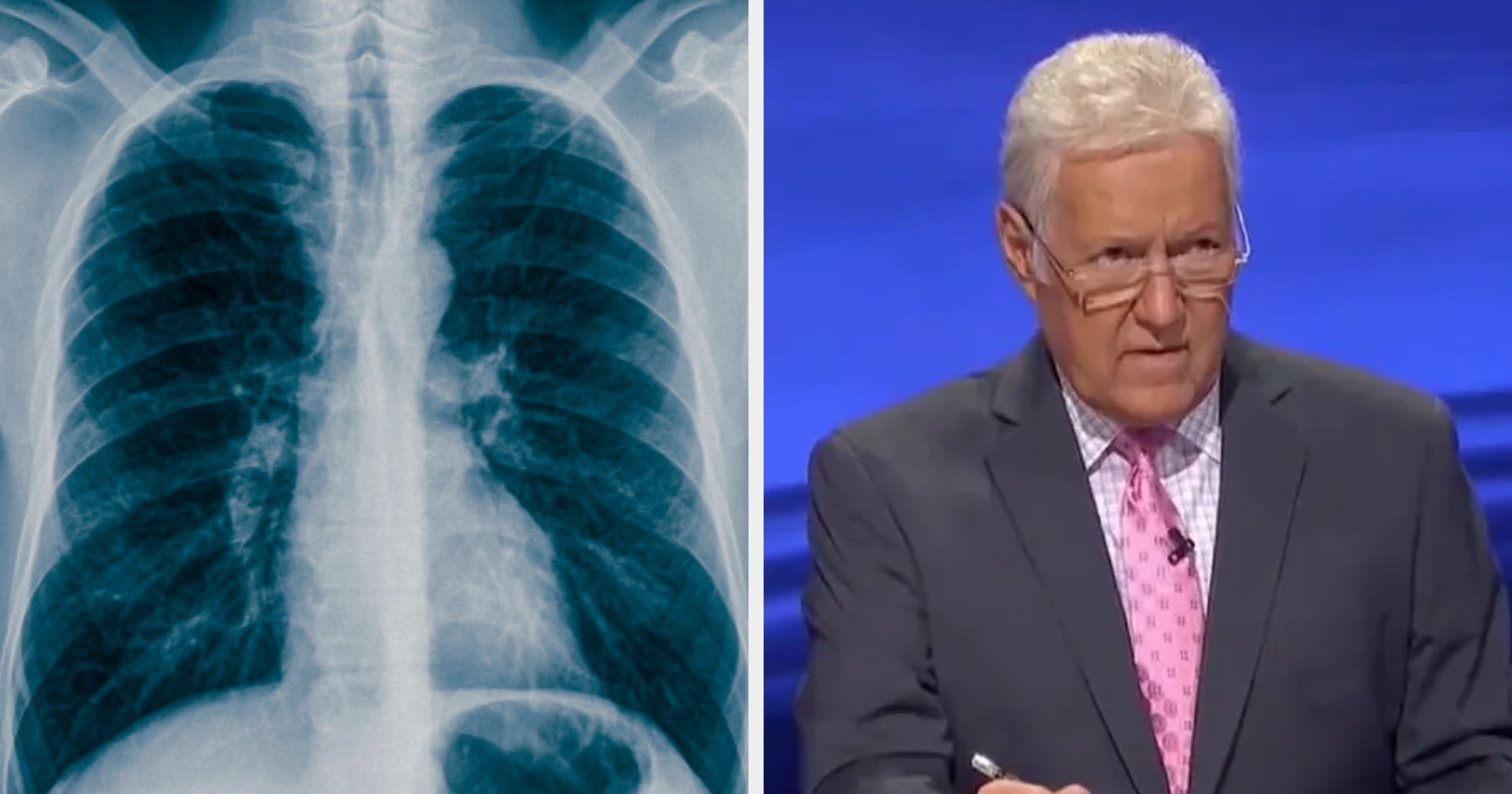 If You Can Pass This Medical-Themed "Jeopardy!," Congrats! You're Smarter Than The Average American