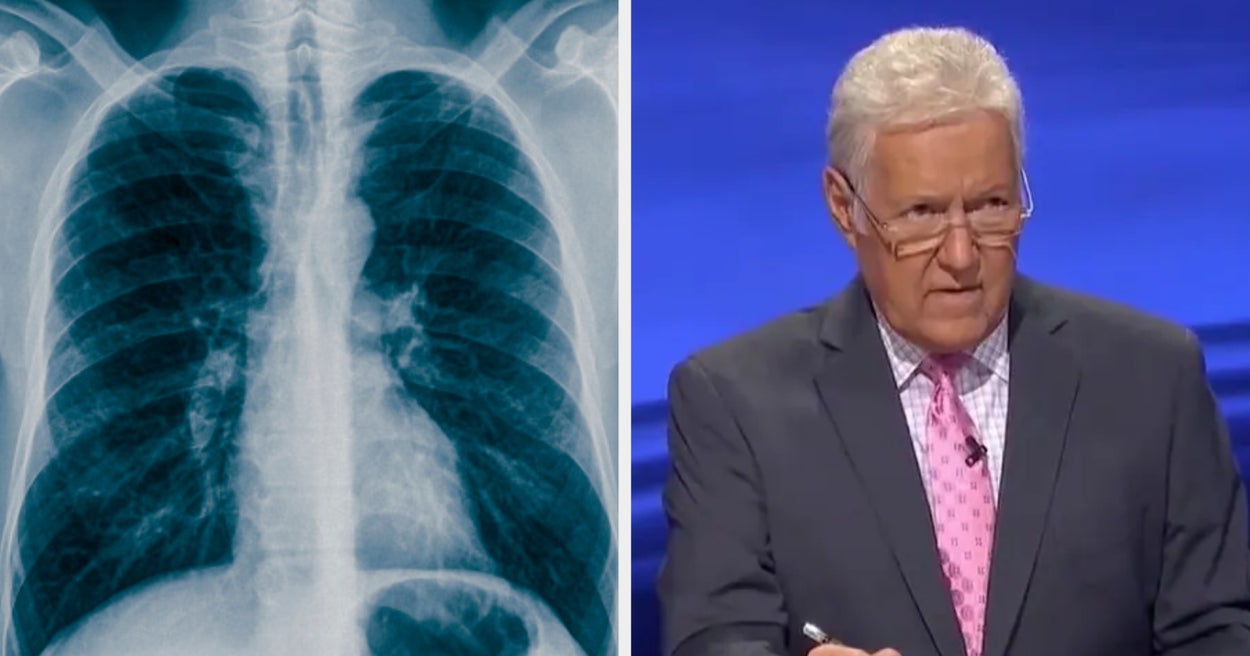 If You Can Pass This Medical-Themed "Jeopardy!," Congrats! You're Smarter Than The Average American