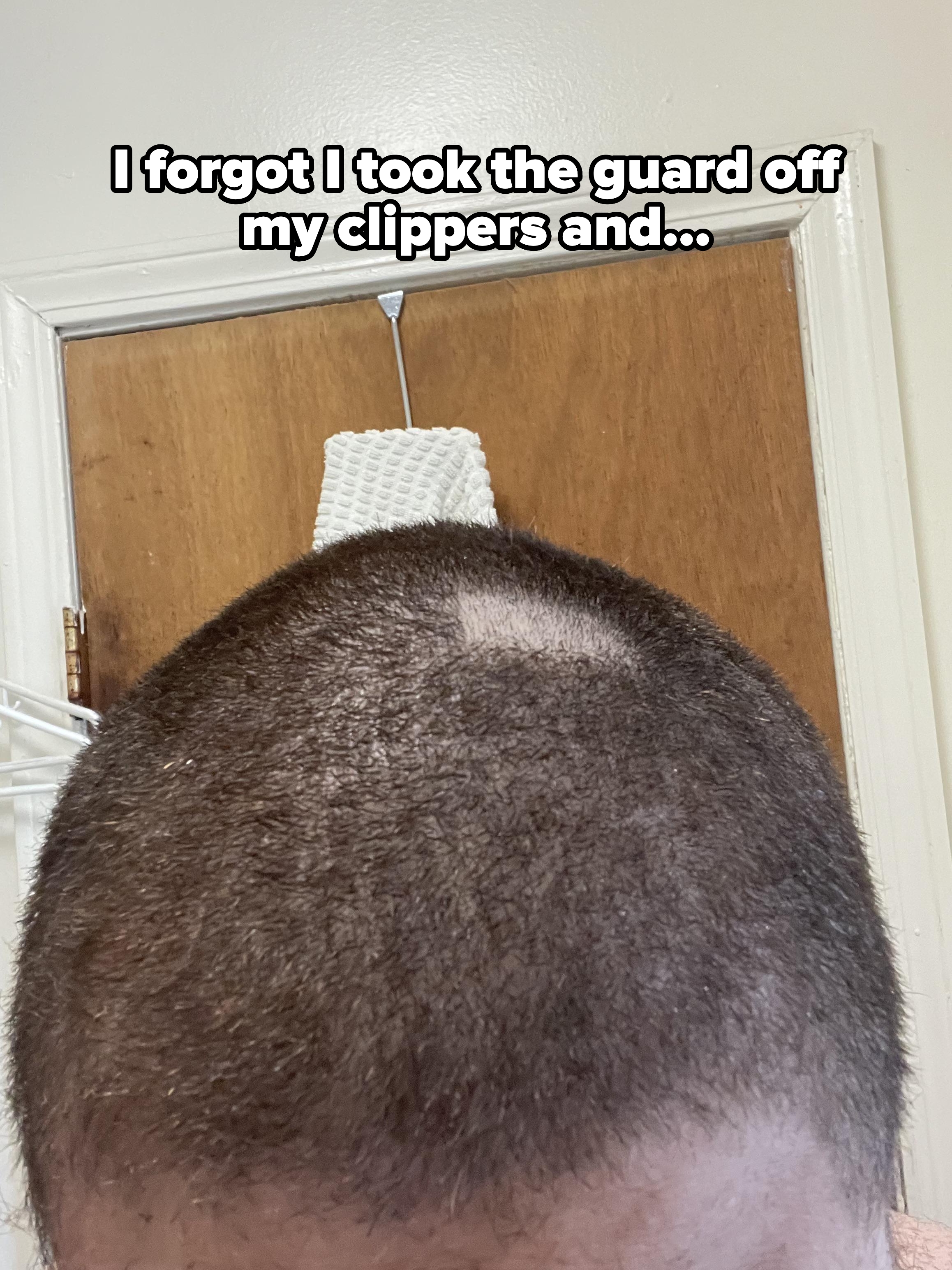 Person with a buzz cut showing a patch of missing hair on top, visible indoors. They are facing a closed wooden door