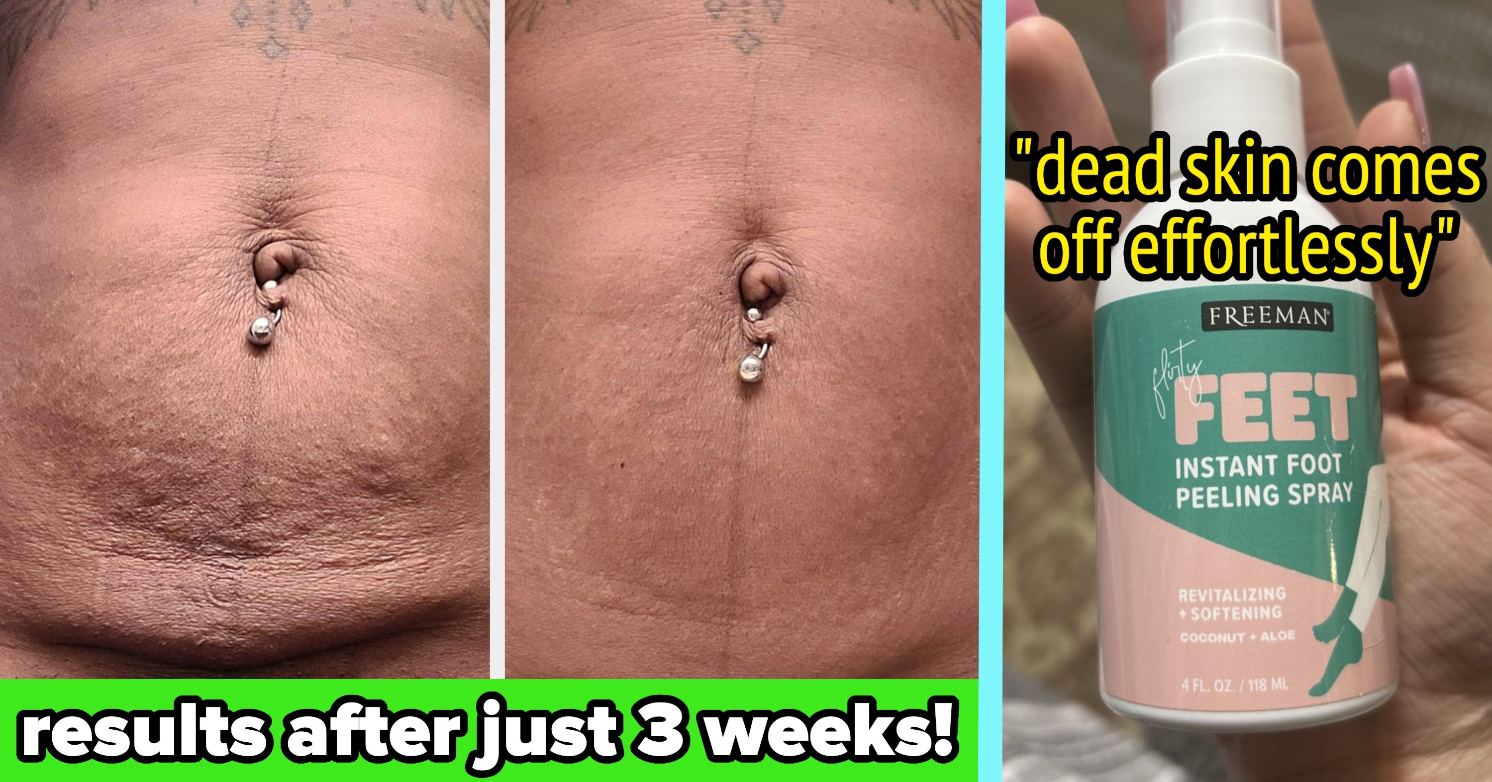 Here Are 34 Things To Help Solve All The "Ugh" Body Issues You Refuse To Discuss With Anyone
