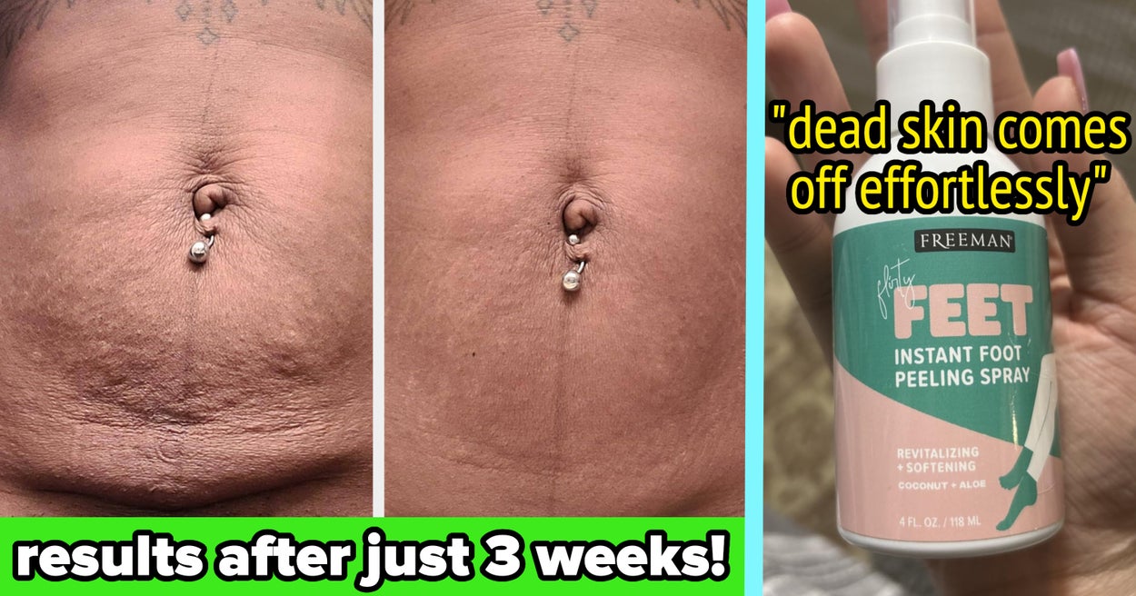 Here Are 34 Things To Help Solve All The "Ugh" Body Issues You Refuse To Discuss With Anyone