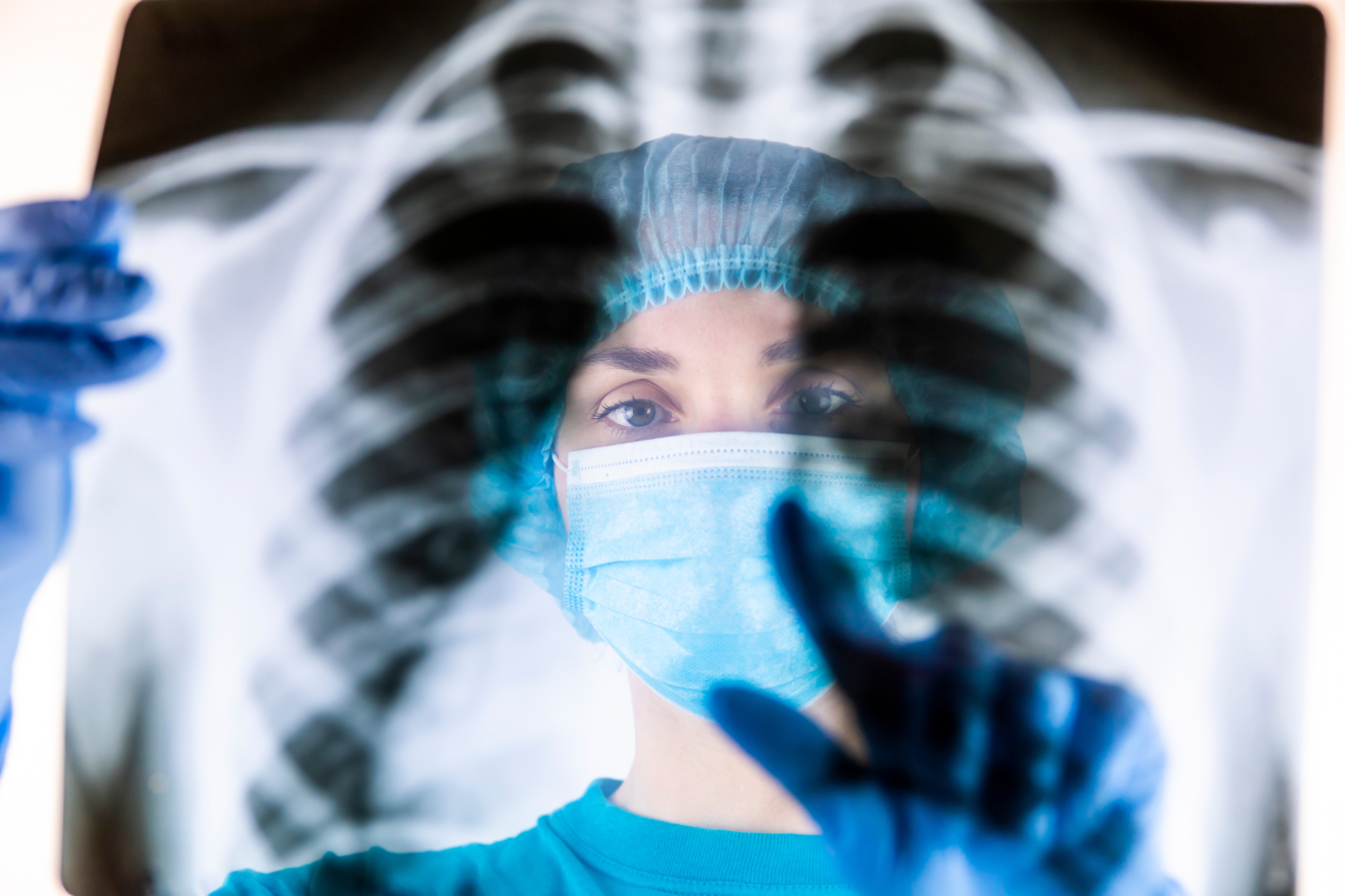 Healthcare professional examines a chest X-ray, wearing a surgical mask, cap, and gloves, indicating careful medical analysis