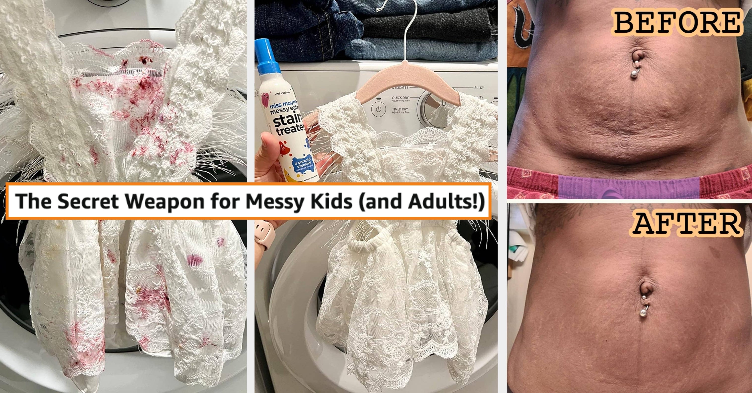 33 Products With Result Photos That Are Downright Shocking