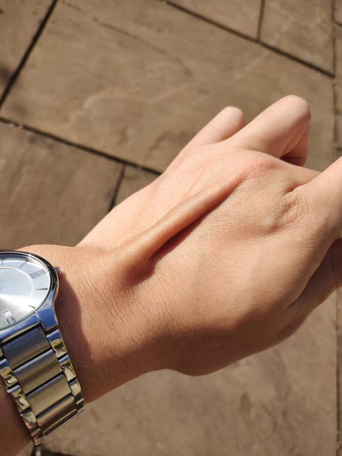 A wristwatch on a wrist with skin gently pinched, showing elasticity. Stone pavement is visible in the background
