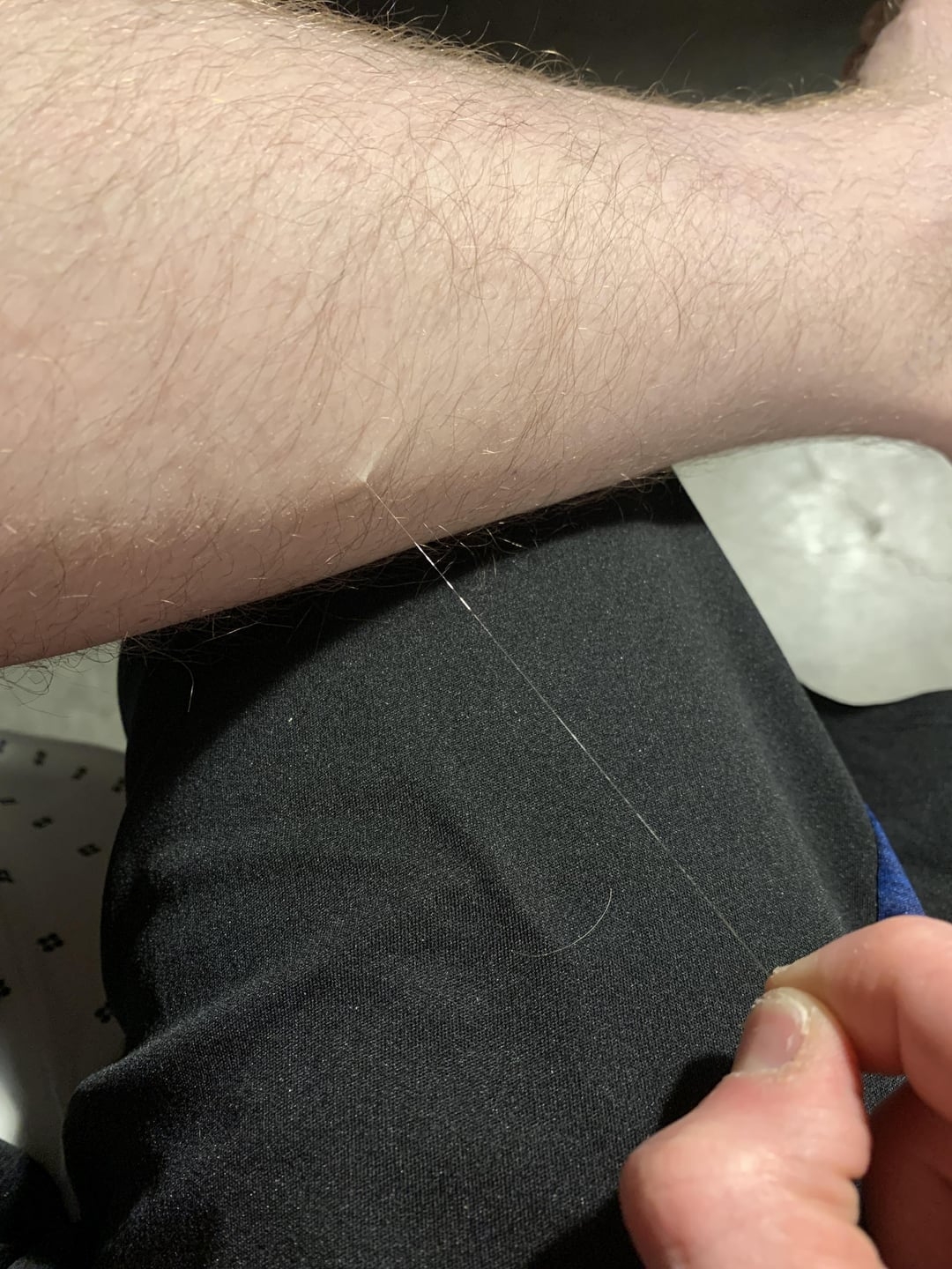 Person plucking a long, thin strand from their arm
