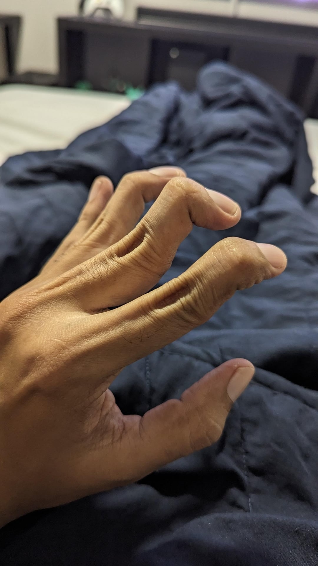 A hand with fingers slightly curled, resting on a dark blanket, viewed from above