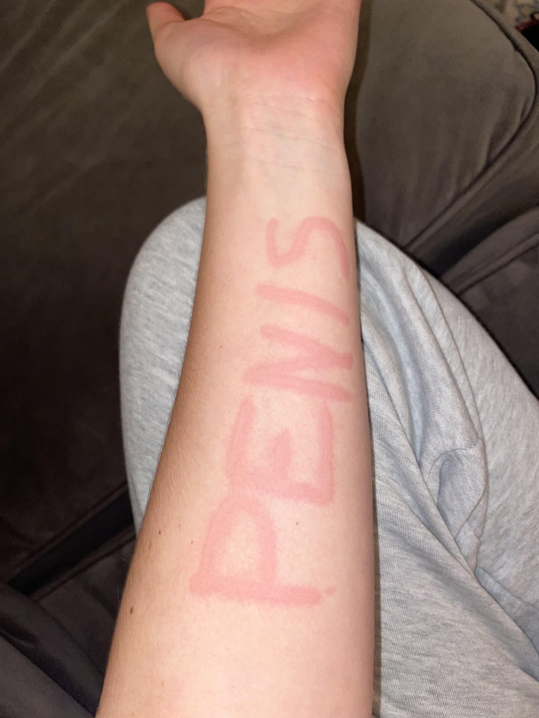 An arm resting on a lap, with the word "PENIS" faintly marked on the forearm