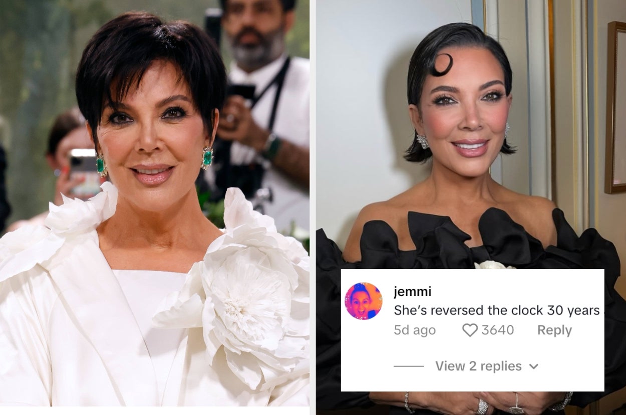 Kris Jenner Is Going Viral For Her Youthful Appearance After Reportedly Getting Cosmetic Enhancements
