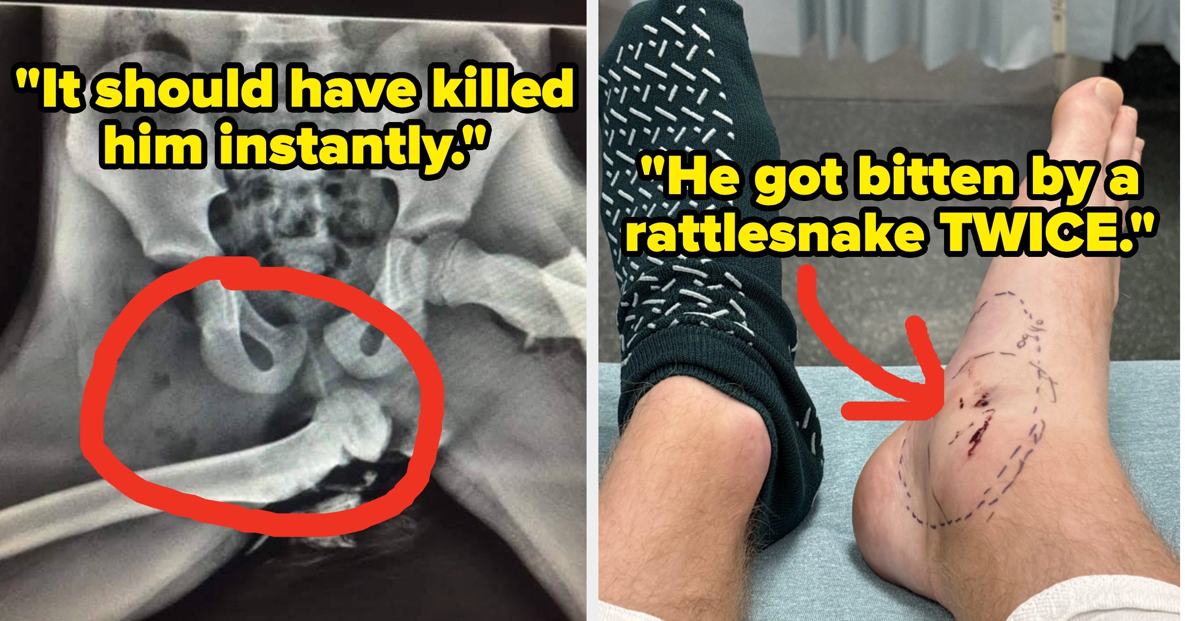 Doctors Are Revealing Their Wildest "You Shouldn't Be Alive" Moments From The ER, And I'm Spooked