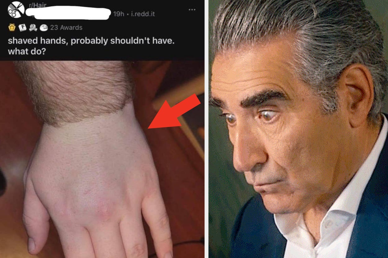 Close-up of a shaved hand with a large red arrow pointing at it. A person looks on with a surprised expression on the right