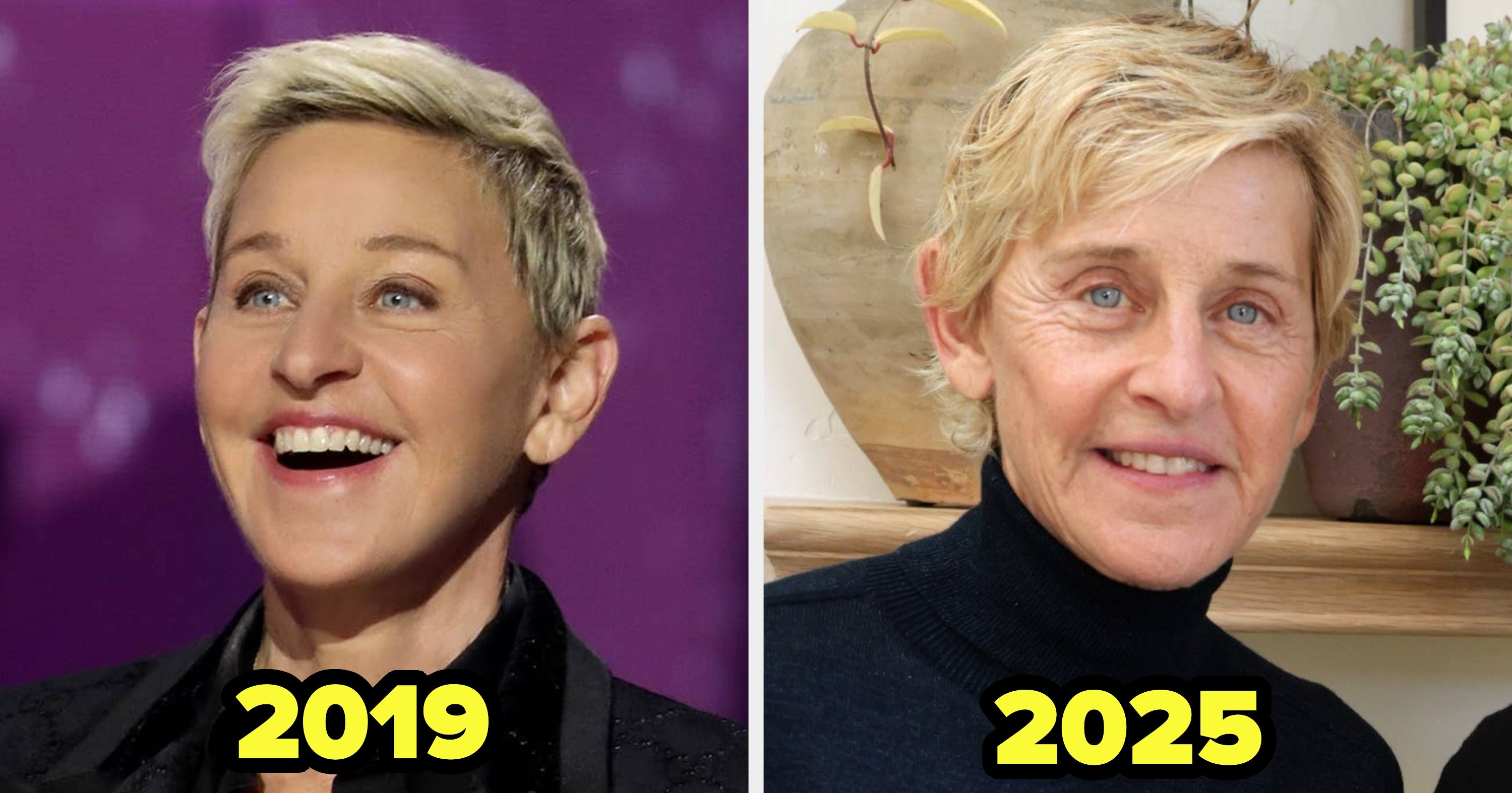 25 Celebs Who Got Rid Of Their Facial Fillers (And Why)